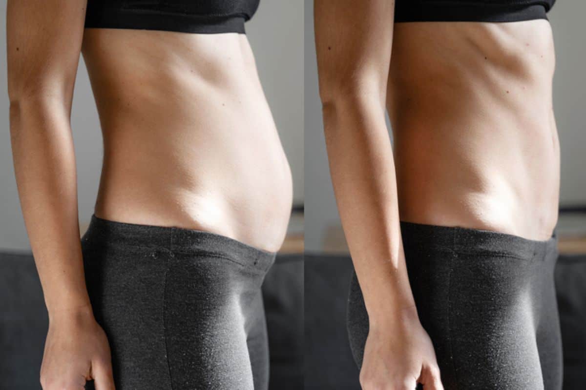 Post-Pregnancy: What Happens to Your Abdominal Muscles After Birth Norwich