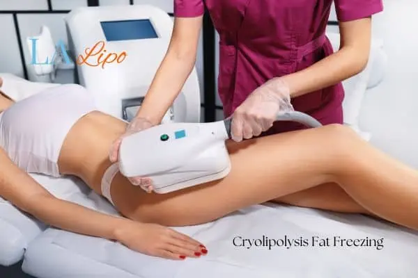 Woman receiving coolsculpting Norwich treatment on her thighs
