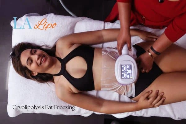 woman getting cryolipolysis Norwich