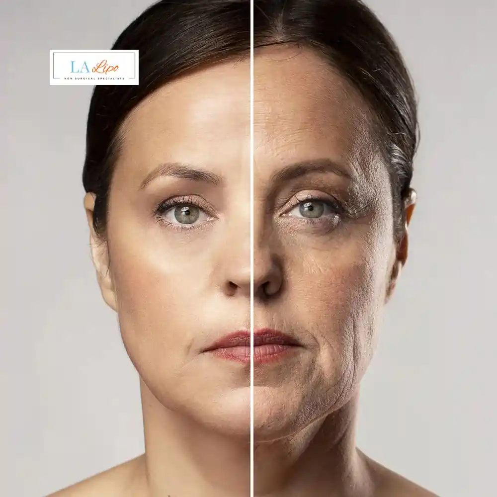 How Can You Tell If Non-Surgical Skin Tightening Is Right for You Norwich?