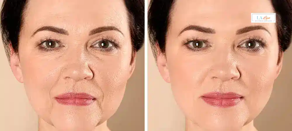 How Long Does It Take to See Results and How Long Do They Last Norwich?