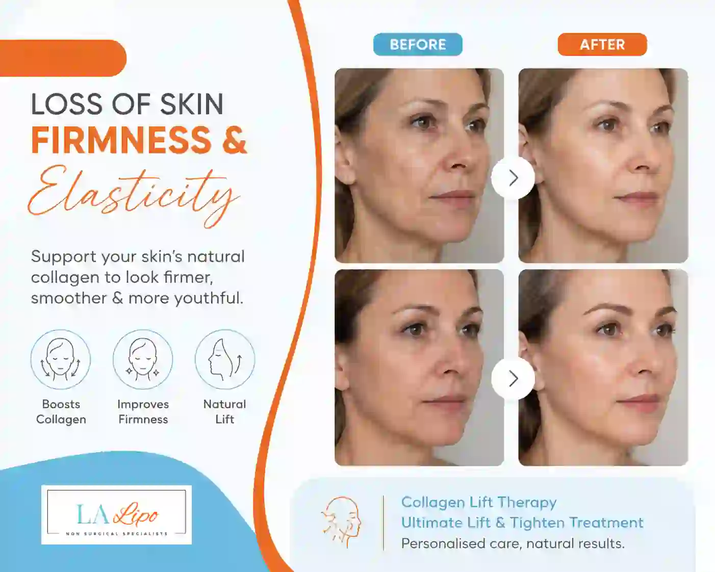 Sign #7: Loss of Skin Firmness and Elasticity Norwich